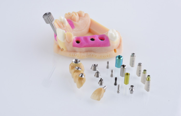 3D-printing and digital models in the dental industry